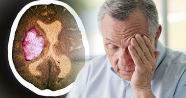 السكتة الدماغية الصباحية: لماذا ترتفع وتيرتها بين السادسة صباحاً والظهيرة؟
